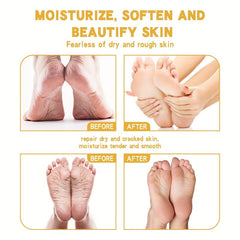 Moisturizing Foot Cream for Dry Cracked Feet - Nourishing Hydrating Skin Care