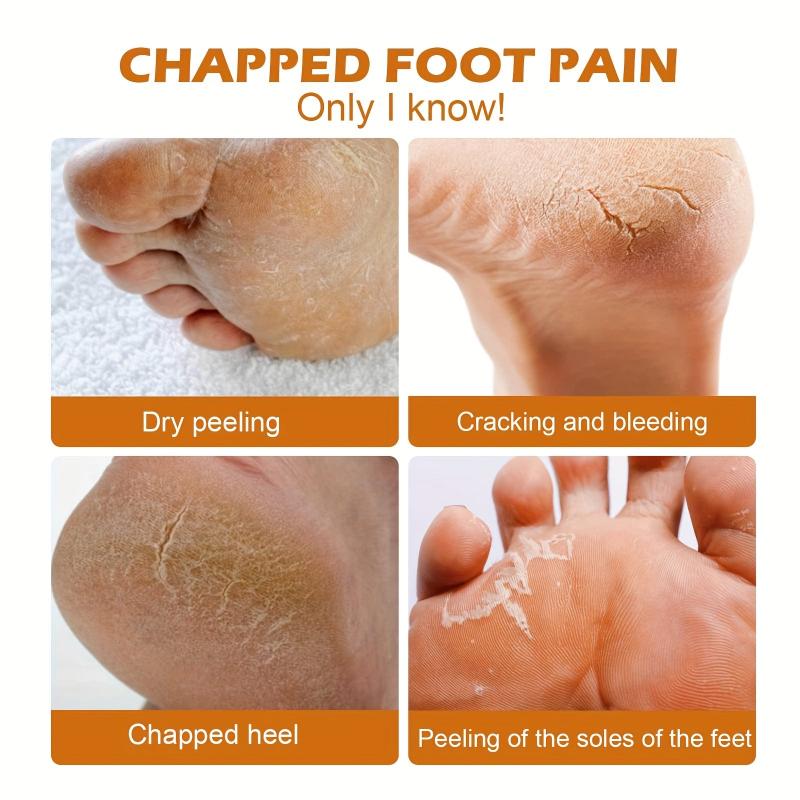 Horse Foot Care Cream for Repairing Dry Heels