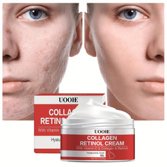 Collagen Retinol Cream 30g Retinol Hyaluronic Acid Vitamin E Collagen