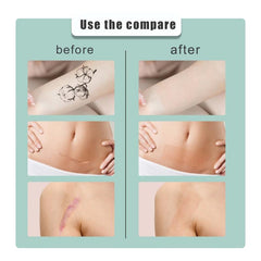 Waterproof South Moon Cover Up Stickers for Tattoo Scar Concealment
