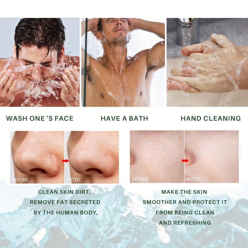 Acne Dark Spot Soap Bar for Face Body Cleansing Bath