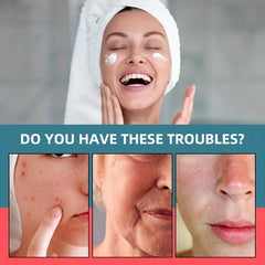 Retinol Cream with Hyaluronic Acid - Reduce Wrinkles, Fine Lines, Dryness