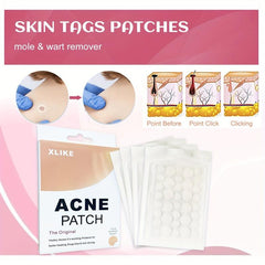 360pcs Hydrocolloid Acne Patch for Acne & Blemishes