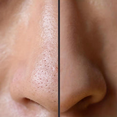2Pcs Deep Cleansing Nose Strips Blackhead Removal