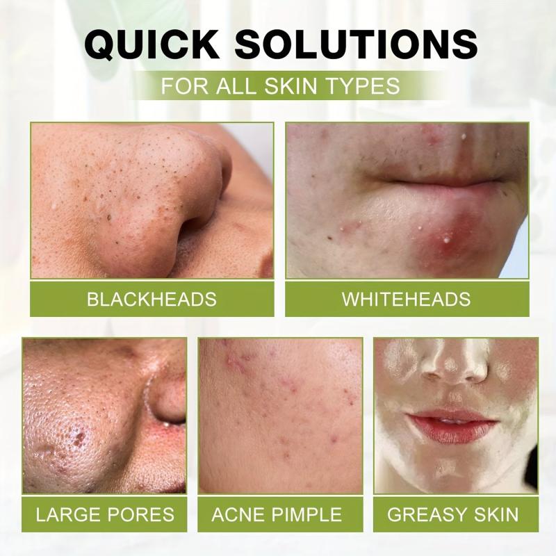Blackhead Mask Deep Cleansing Acne Nose Mask for Clearer Skin