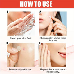 Acne Pimple Patch for Zits and Blemishes Spot Stickers