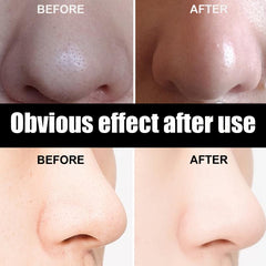 2pcs 30g Blackhead Removal Nasal Mask Removes Dirt and Acne with 60 Sheets