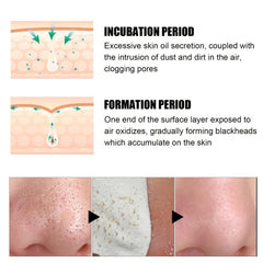 2pcs 30g Blackhead Removal Nasal Mask Removes Dirt and Acne with 60 Sheets
