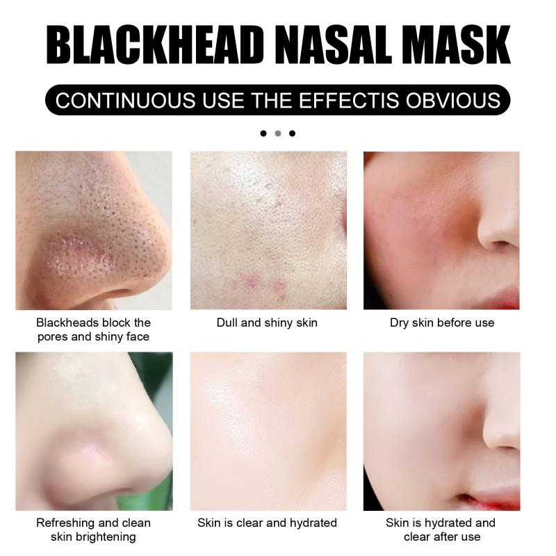 2pcs 30g Blackhead Removal Nasal Mask Removes Dirt and Acne with 60 Sheets