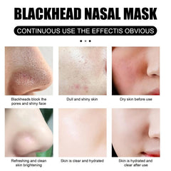 2pcs 30g Blackhead Removal Nasal Mask Removes Dirt and Acne with 60 Sheets
