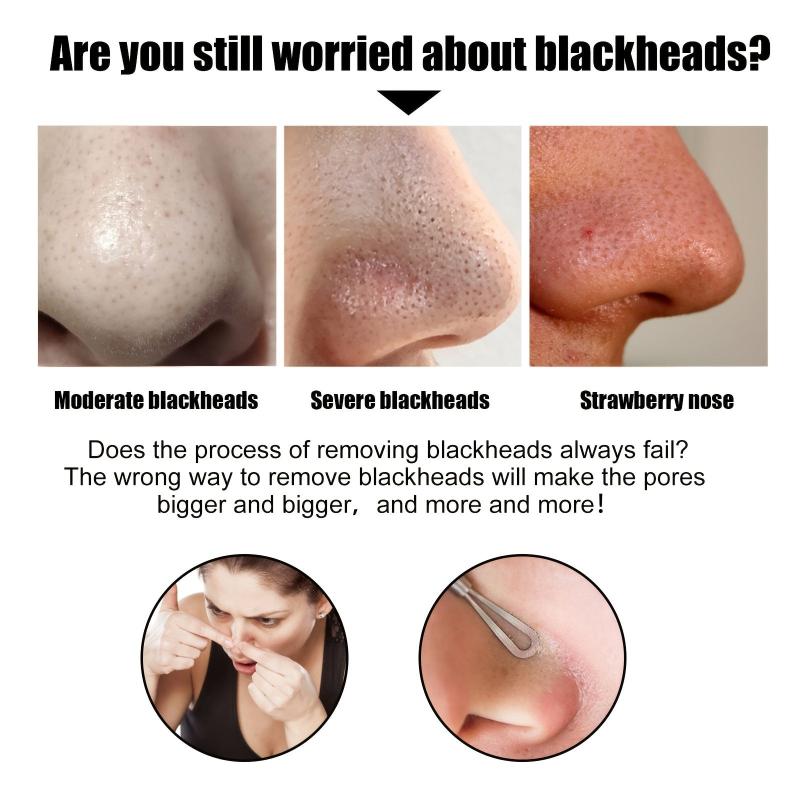 2pcs 30g Blackhead Removal Nasal Mask Removes Dirt and Acne with 60 Sheets