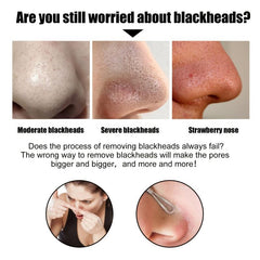 2pcs 30g Blackhead Removal Nasal Mask Removes Dirt and Acne with 60 Sheets