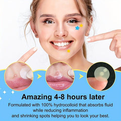 126pcs Invisible Acne Removal Pimple Patch Beauty Tools