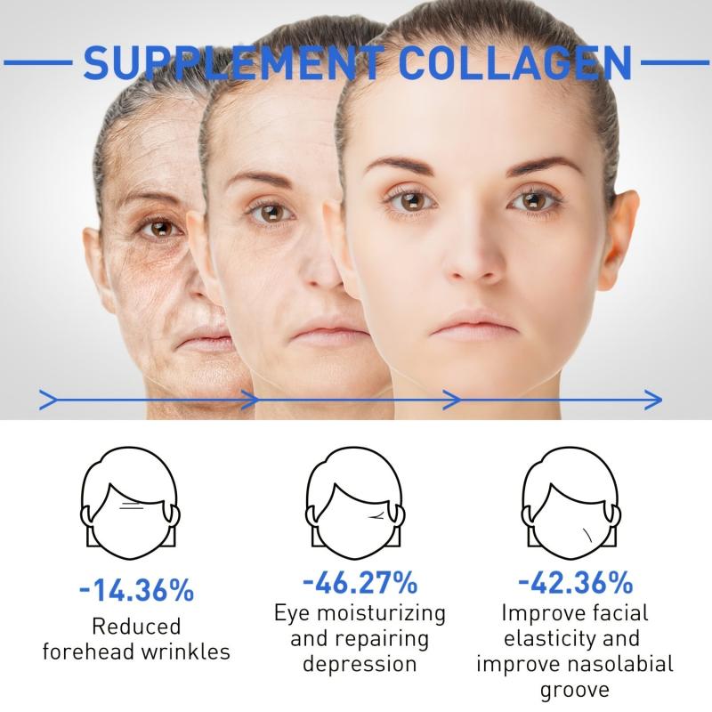 50g Botox Solution Facial Serum Reduce Wrinkles Signs of Aging Moisturizes Skin