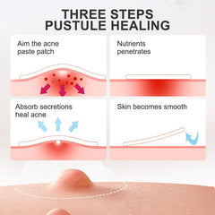 24 Pcs Invisible Acne Patch Skin Acne Removal Patch Waterproof