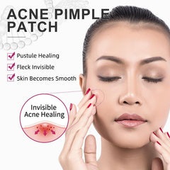 24 Pcs Invisible Acne Patch Skin Acne Removal Patch Waterproof