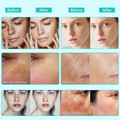 Dark Spot Removal Cream For Face - Firming Skin Tightening & Moisturizing