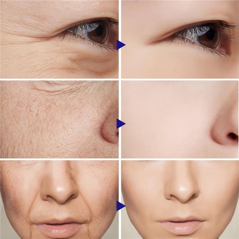 Retinol Facial Cream with Hyaluronic Acid Collagen Moisturizer