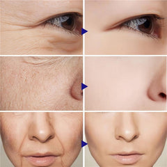 Retinol Facial Cream with Hyaluronic Acid Collagen Moisturizer
