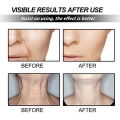 Retinol Facial Cream with Hyaluronic Acid Collagen Moisturizer
