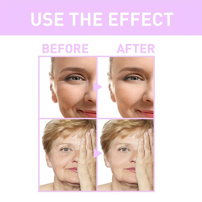 Retinol Facial Cream with Hyaluronic Acid Collagen Moisturizer