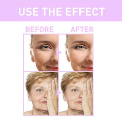 Retinol Facial Cream with Hyaluronic Acid Collagen Moisturizer
