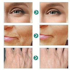 Retinol Cream & Hyaluronic Acid Advanced Formula