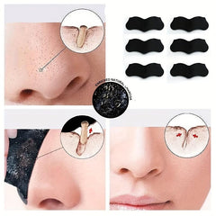 180pcs Blackhead Remover Nose Patch Acne Nose Mask
