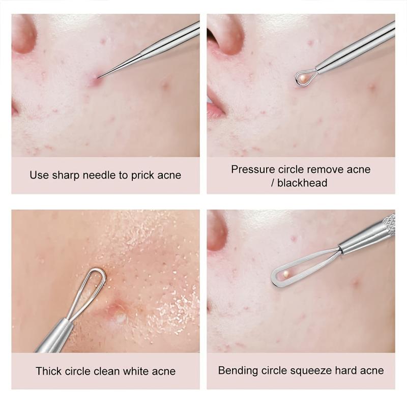 Stainless Steel Acne Clips Cell Clips Acne Needles - 5 Sets