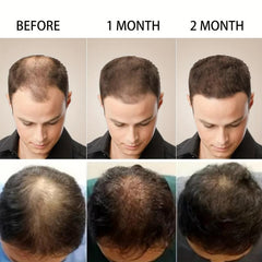 Hair Stronger Cream w/ Biotin & Saw Palmetto