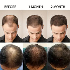 Sesame Hair Cream - Repairs Split Ends & Damaged Hair - Deeply Moisturizes Hair