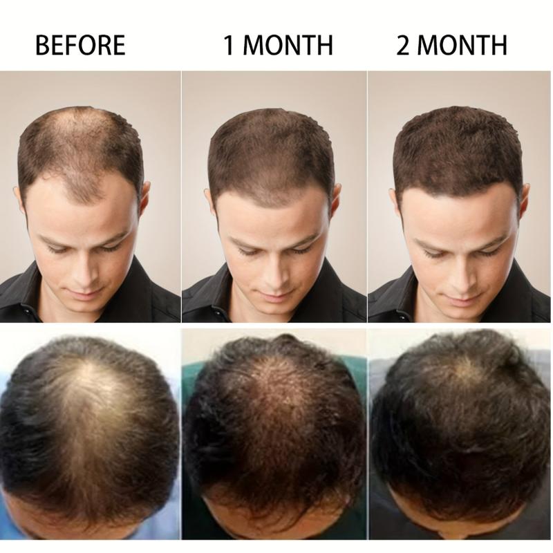 50g Hair Cream Strengthens Healthy Hair with Ginger Essential Oil