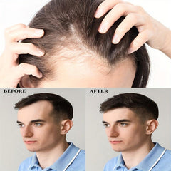 25ml Hair Care Spray Revitalizes Thin Hair for Men & Women