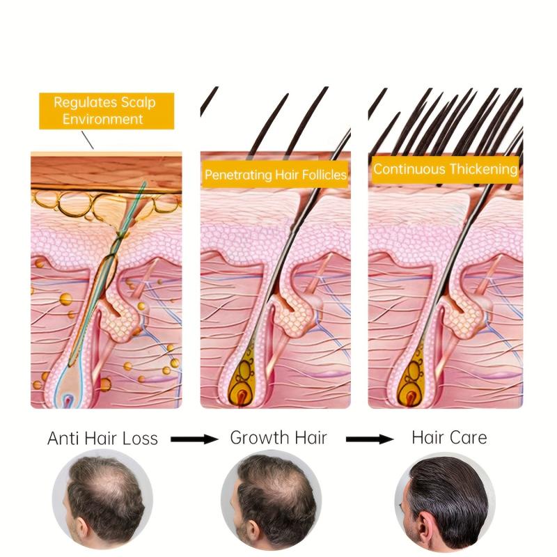 50g Scalp Spot Cream Daily Hair Care Cream For Women Men