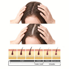 50g Scalp Spot Cream Daily Hair Care Cream For Women Men