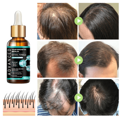 Ginger Hair Care Vitamins Natural Hair Serum for Thicker Healthier Hair