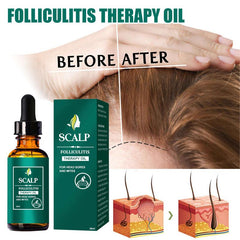 Peppermint Scalp Hair Care - Split Ends & Dry Scalp - All Hair Types