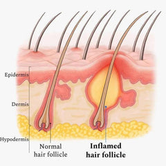 Peppermint Scalp Hair Care - Split Ends & Dry Scalp - All Hair Types