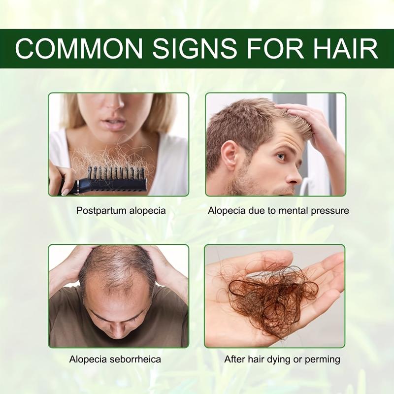 Rosemary Mint Scalp & Hair Strengthening with Biotin - Repair Split Ends