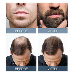 Herbal Hair Essence Massage Scalp & Hair Root Beard Care Essence