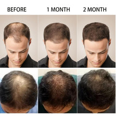 Hair Care Serum With Biotin & Vitamins C & E