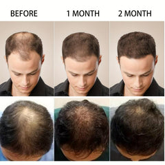Ginger Hair Essential Long Lasting Hair Care Serum