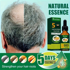 Ginger Hair Care Essential Hair Liquid Plant Extract Serum