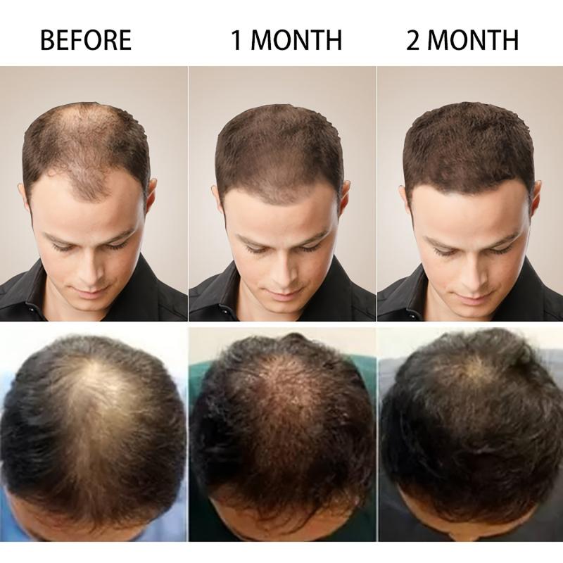 30ml Hair Serum for Repairing Damaged Dry Hair