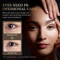 40g Golden Hyaluronic Acid Eye Cream for Moisturized Skin & Smooth Fine Lines