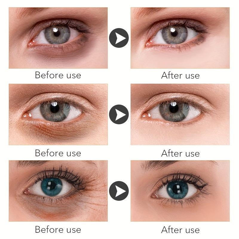 Rewind Eye Cream Dark Circles Wrinkles Puffiness