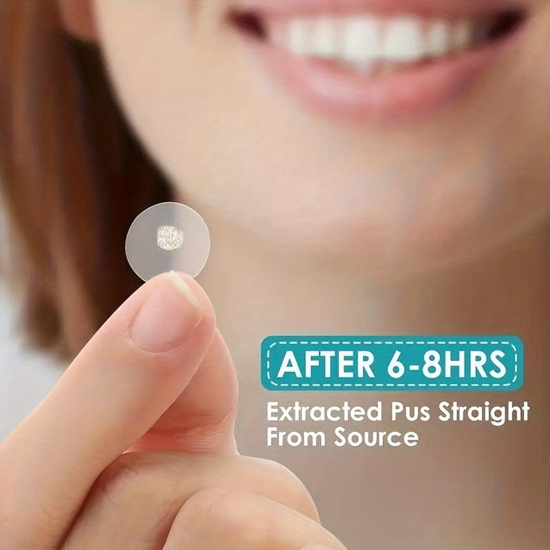 Acne Pimple Patch 72 Pcs Hydrocolloid Spot Stickers Vegan