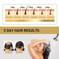 Ginger Hair Care Shampoo Repair Split Dry Hair Strong Hair Roots