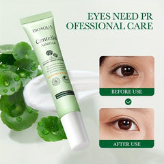 Organic Centella Eye Gel for Puffiness & Dark Circles
