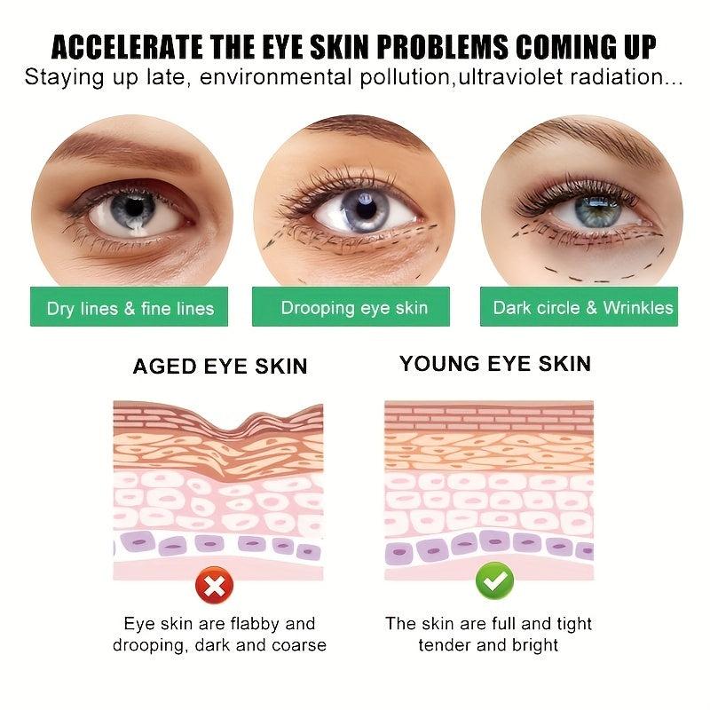 Retinol Under Eye Cream Dark Circles Puffiness Wrinkle Cream